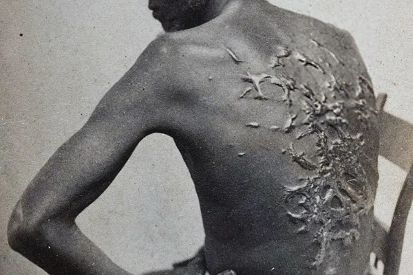 scourged_back_by_mcpherson_oliver_1863_1.jpg